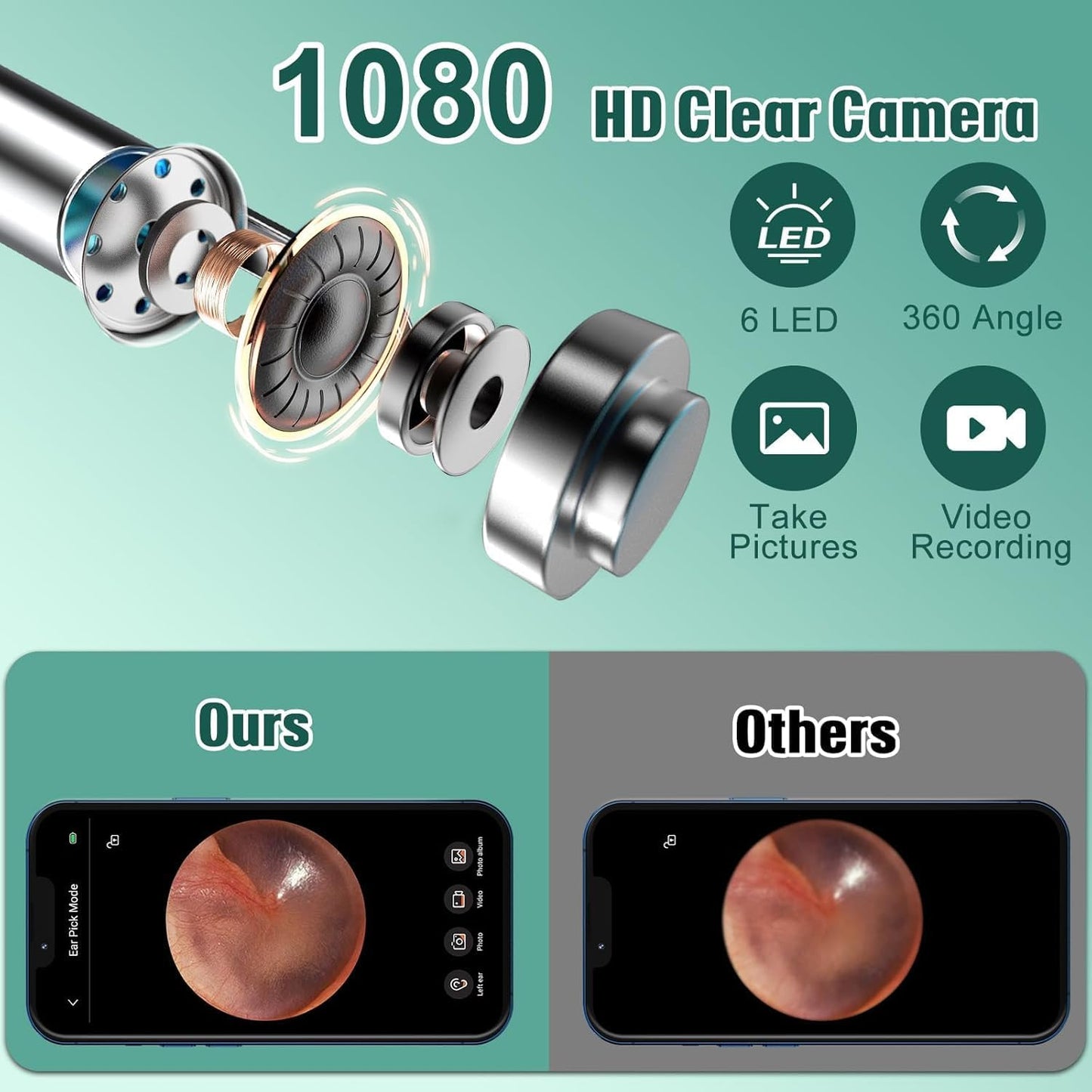 Ear Wax Removal Otoscope with Camera