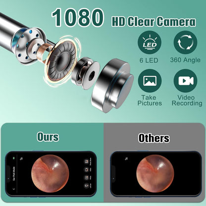 Ear Wax Removal Otoscope with Camera