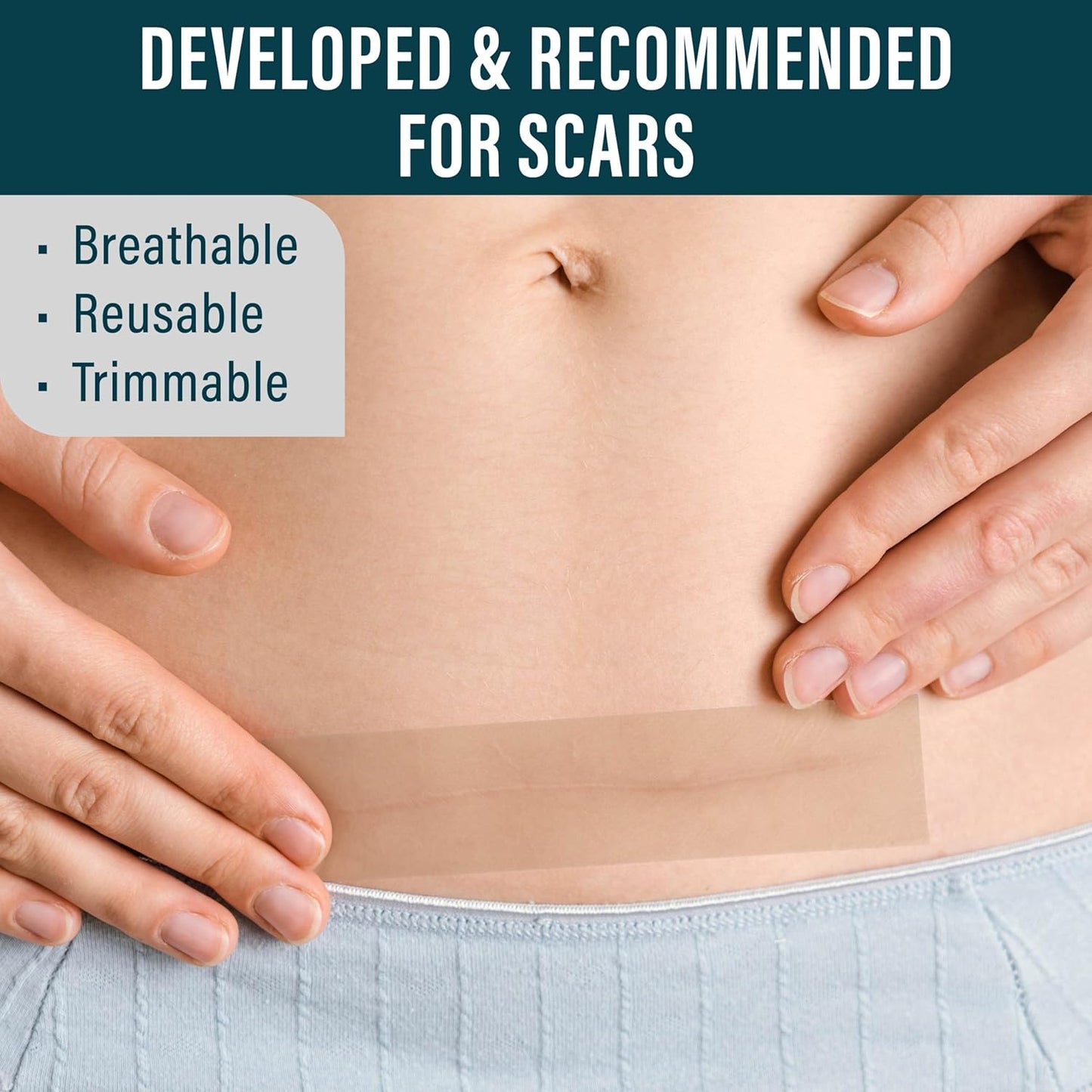 Medical-Grade Silicone Scar Tape