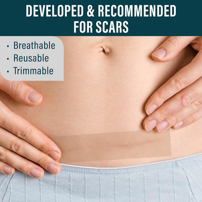 Medical-Grade Silicone Scar Tape