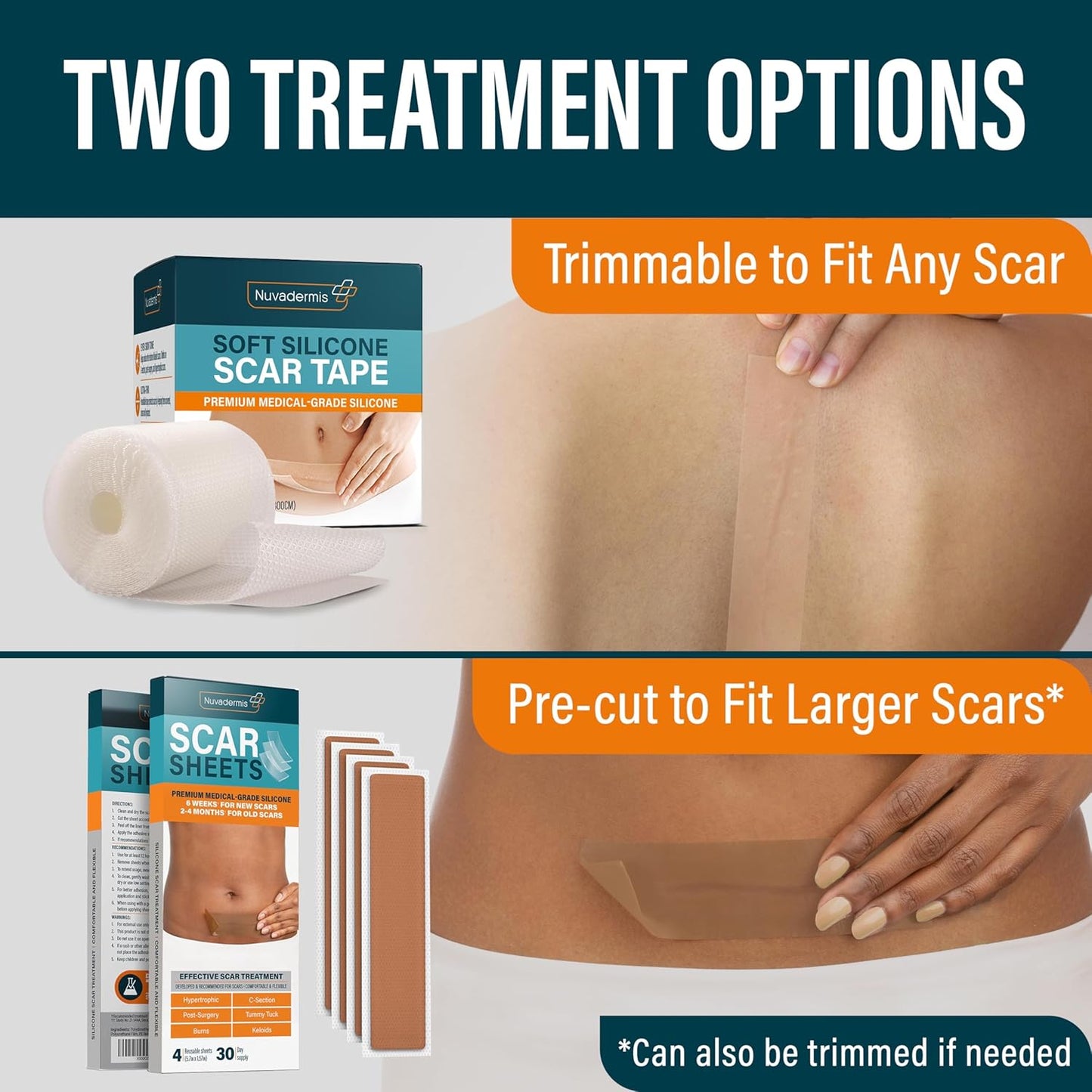Medical-Grade Silicone Scar Tape